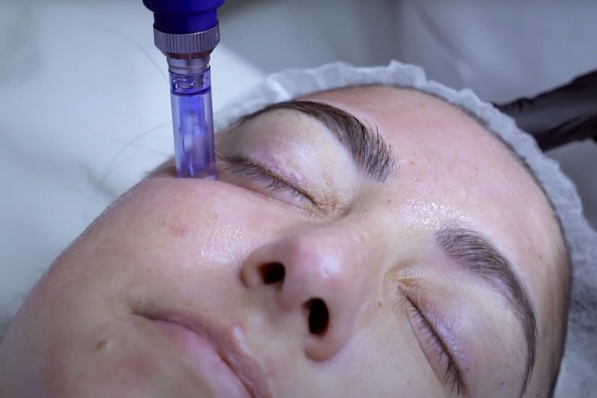 Curso Dermapen y CC Glow en Sevilla