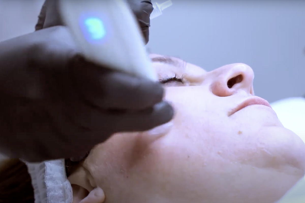 Curso Bioplacenta con Hydrapen en Sevilla
