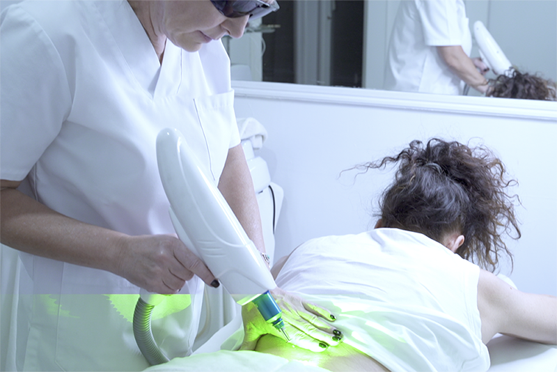 Eliminar Tatuajes en Sevilla