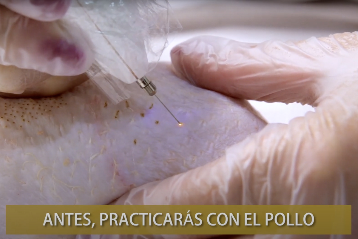 Curso de Plasma Pen Fibroblast en Sevilla